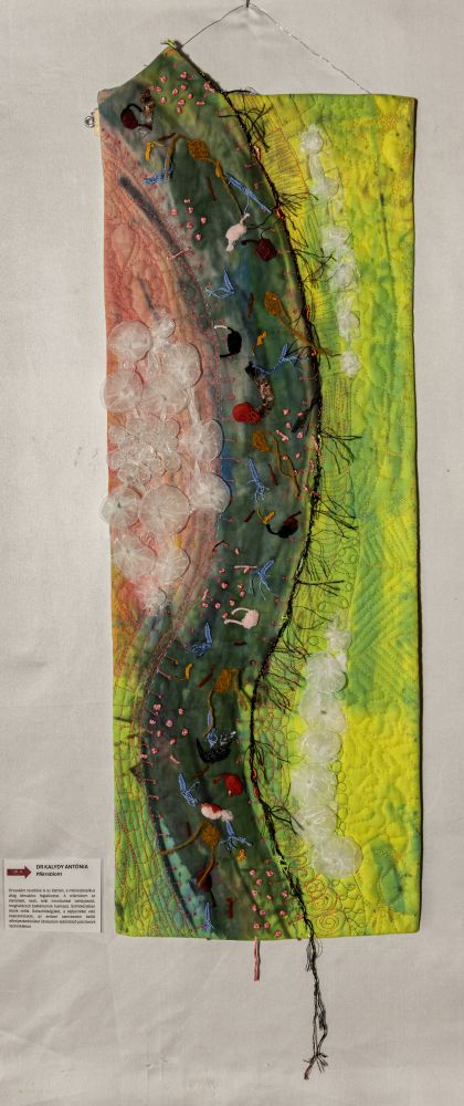 Tol-Ig II – Dr Kalydy Antónia – Mikrobiom